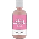Amazon Basics Medicated Calamine Anti-Itch Lotion, Analgesic Skin Protectant, 6 Fluid Ounce, 1-Pack (Previously Solimo) (New